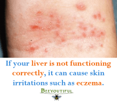 liver_eczema